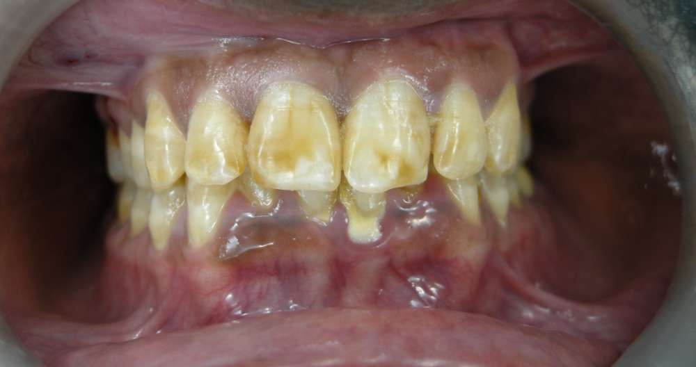 Patient 7 Before