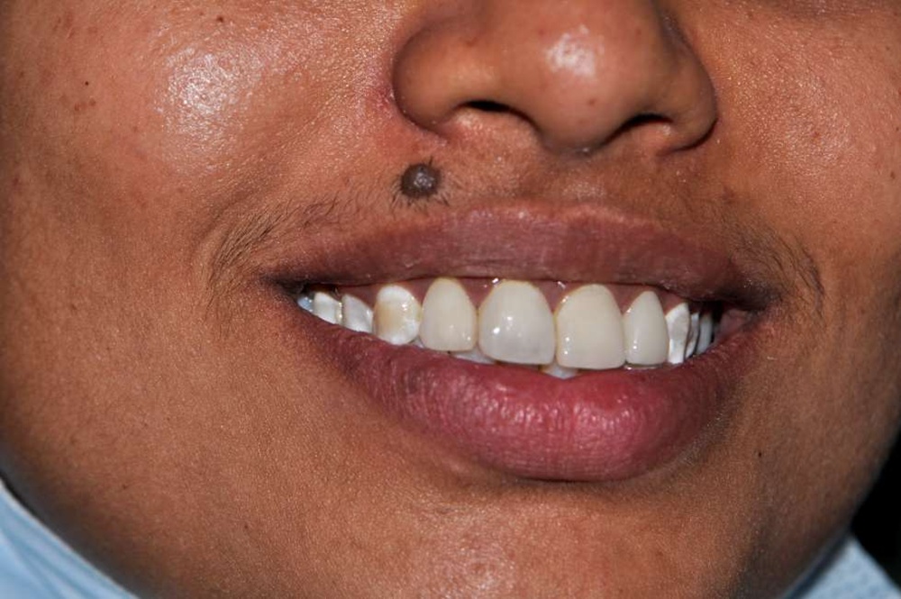 Patient 8 After